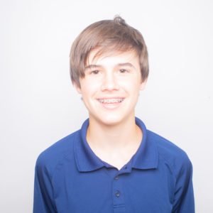 Carter Higgins Patients Pre 40 300x300 - Financing FAQ