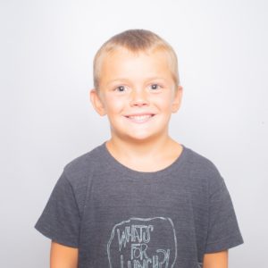 Carter Higgins Patients Pre 48 300x300 - Financing FAQ